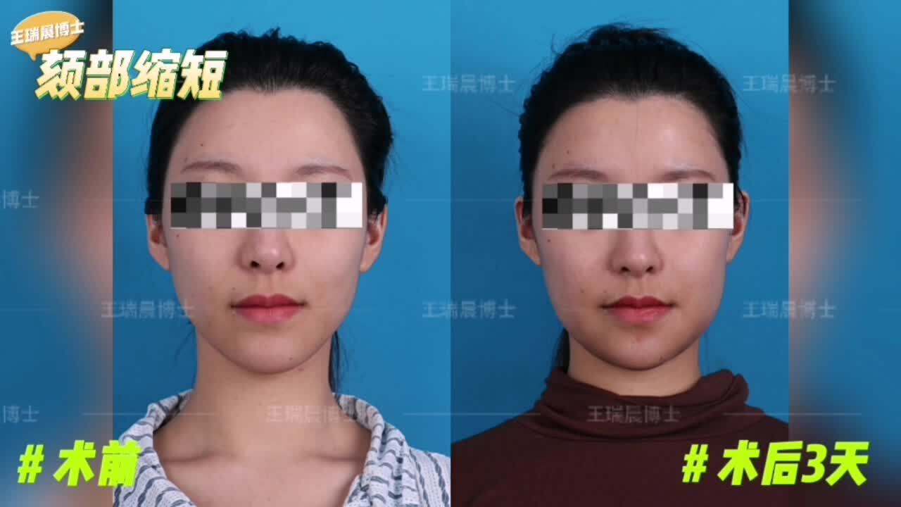 視頻封面