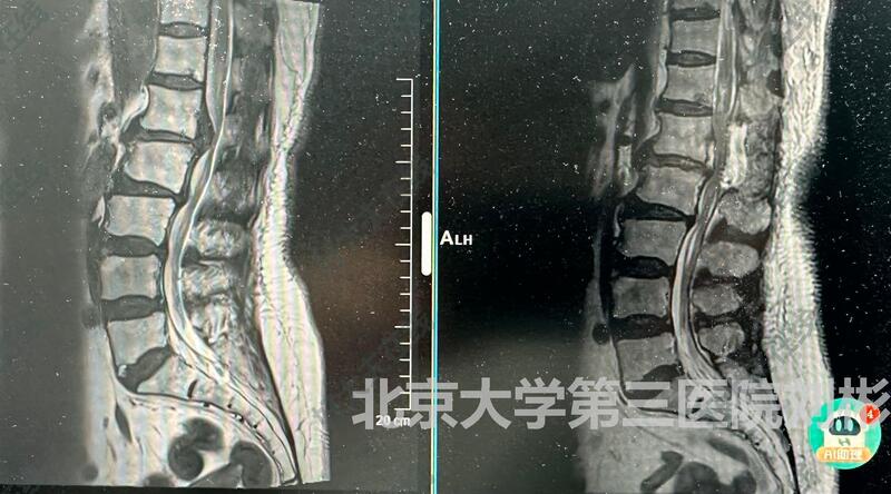 圖文圖片
