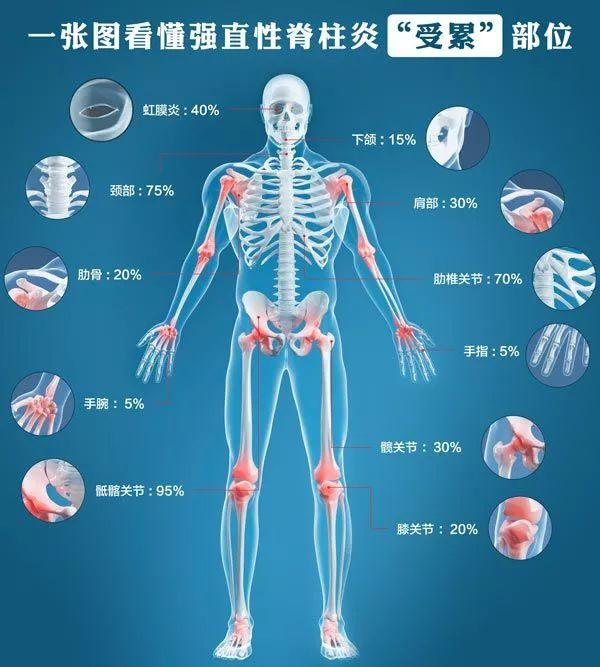 婴儿四肢强直图片图片