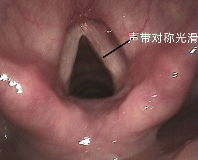 圖文圖片