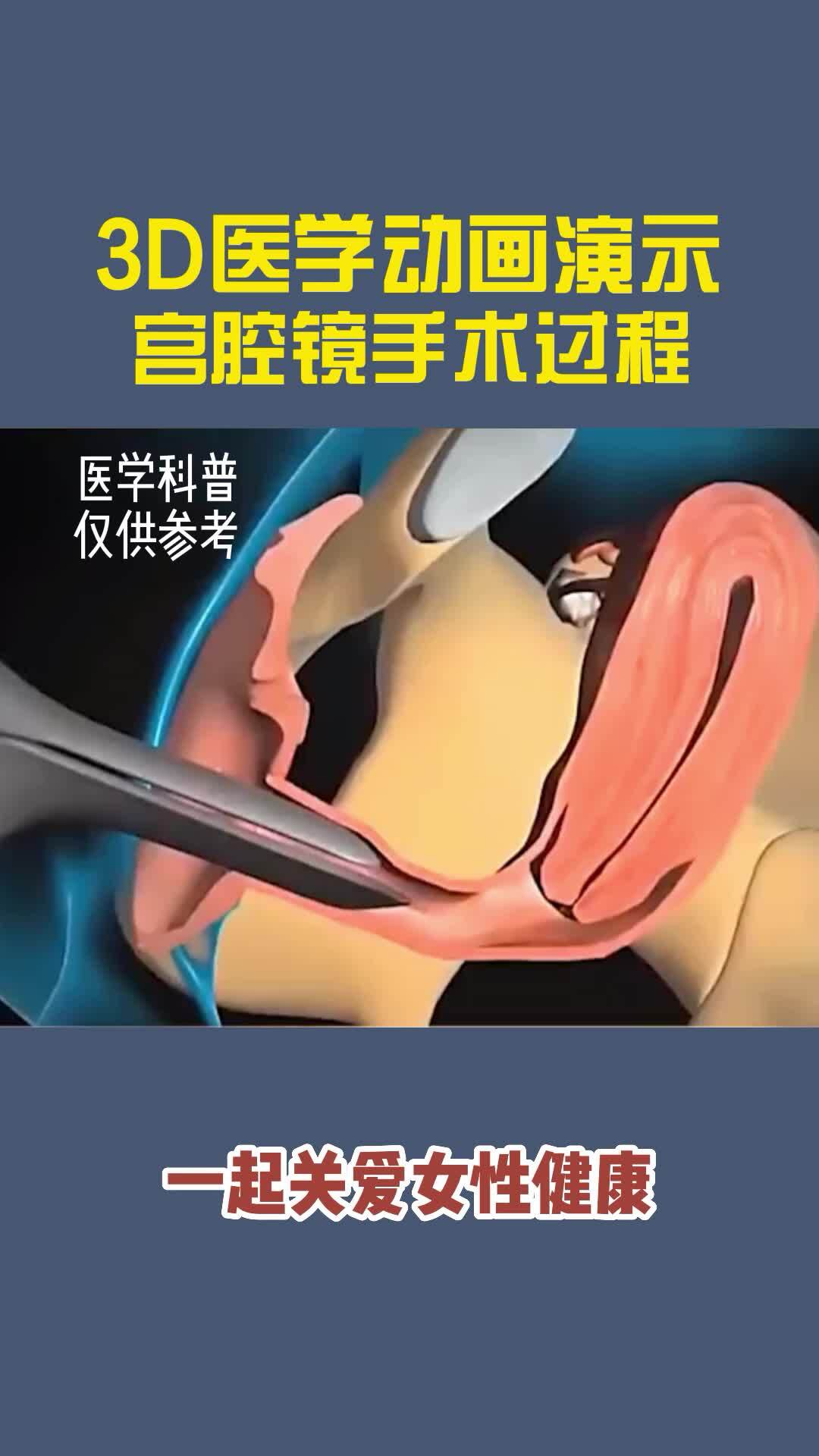視頻封面