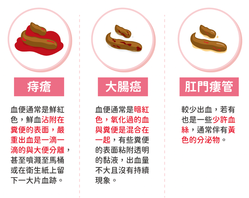 圖文圖片