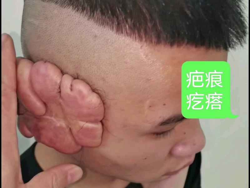 視頻封面