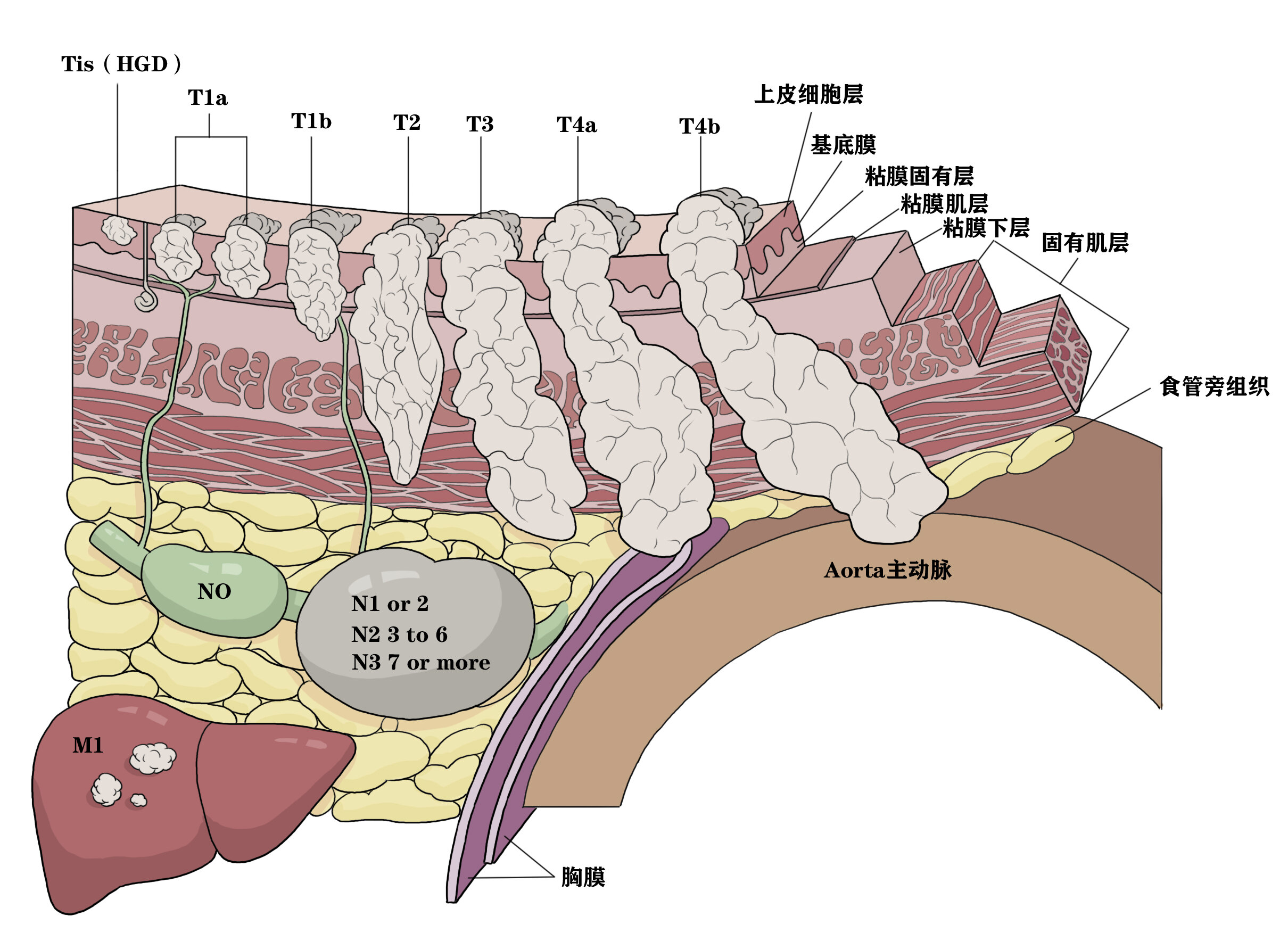 食管壁结构图片