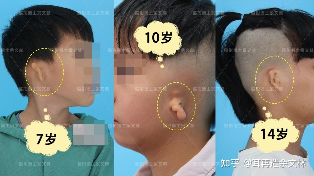 圖文圖片