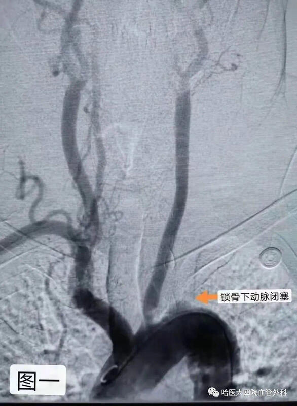 圖文圖片