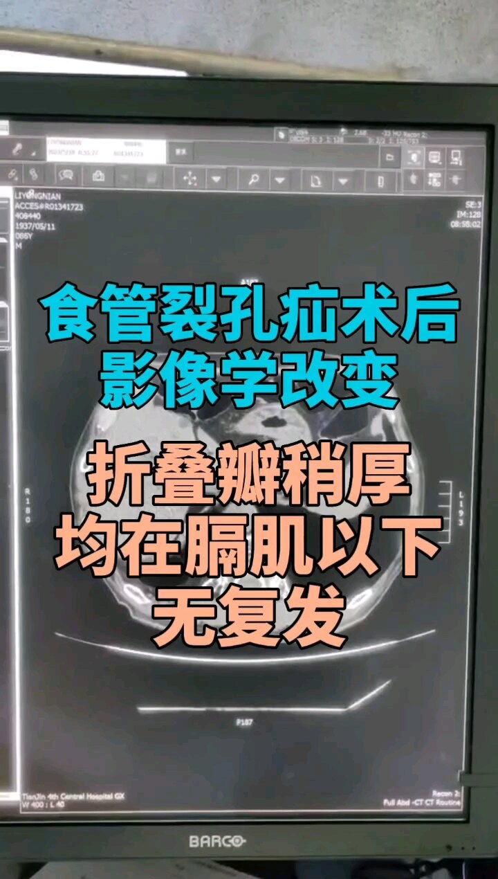 默认图片