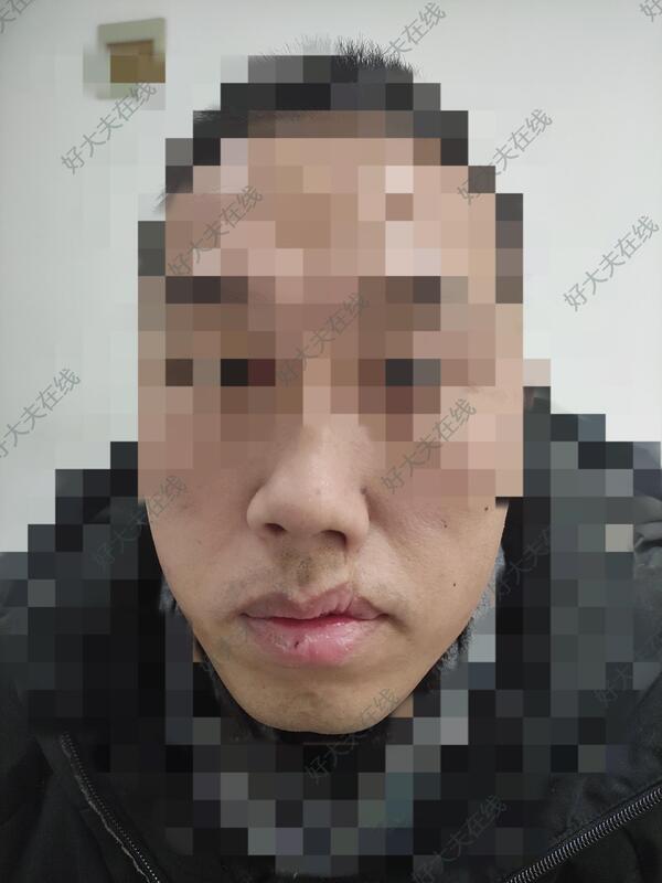 圖文圖片