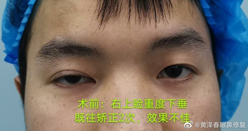 圖文圖片