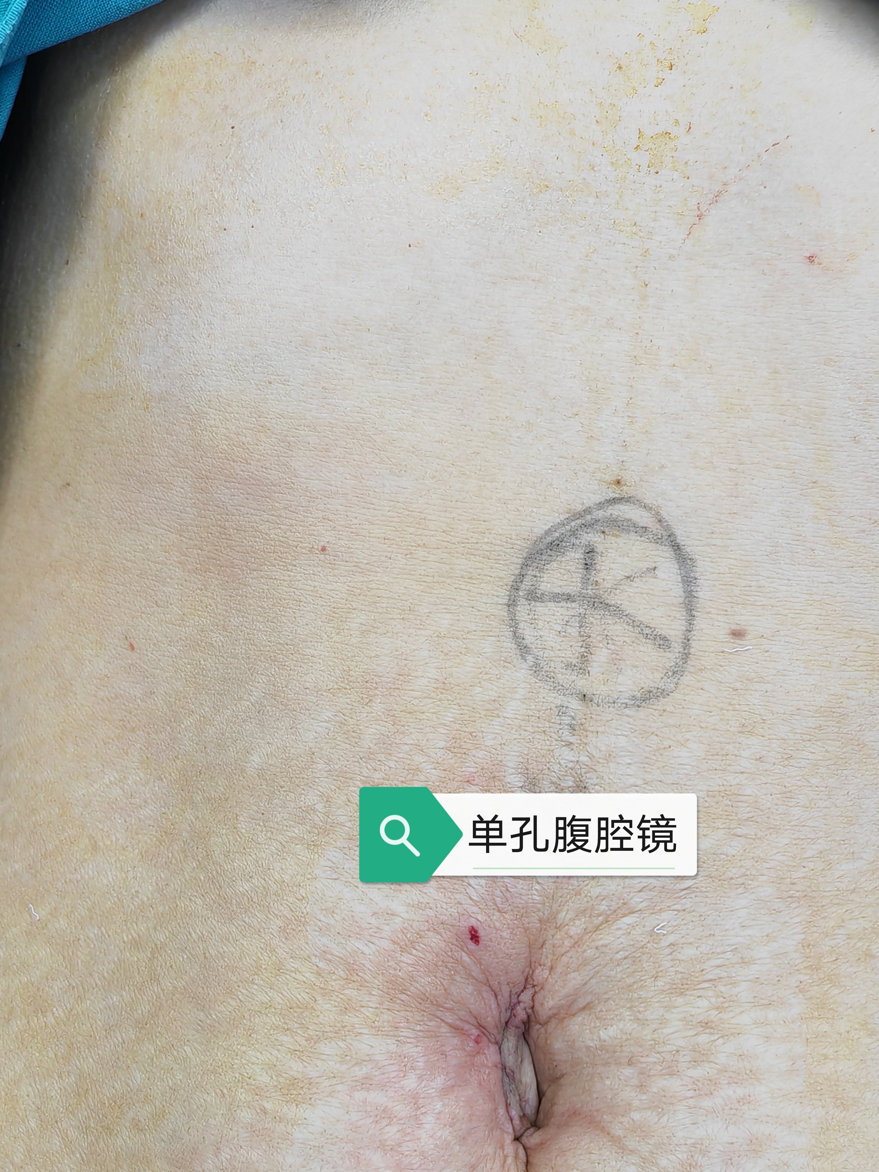 圖文圖片
