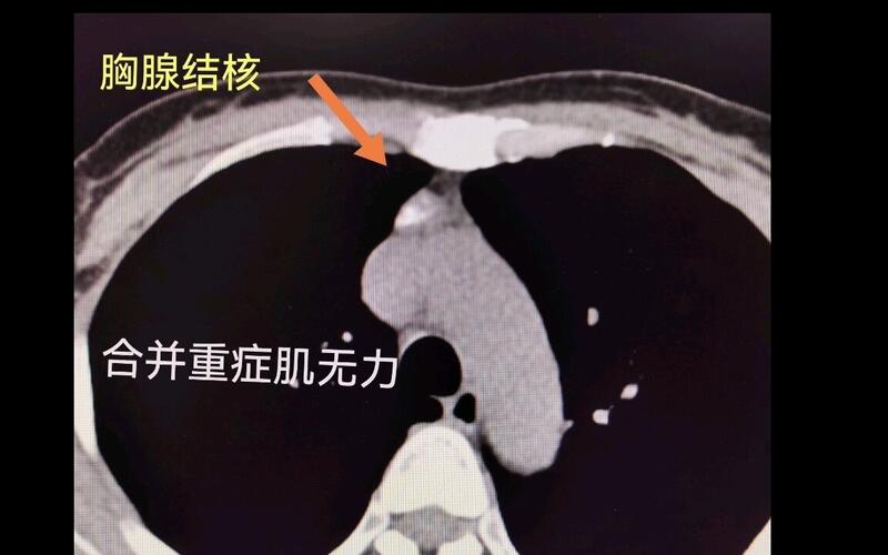 視頻封面