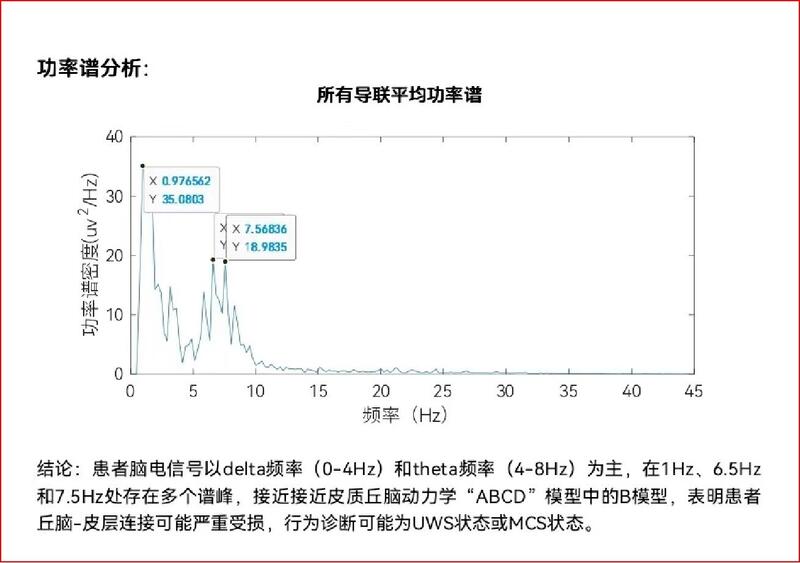 频率谱分析.jpg