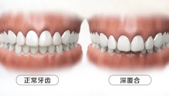 圖文圖片