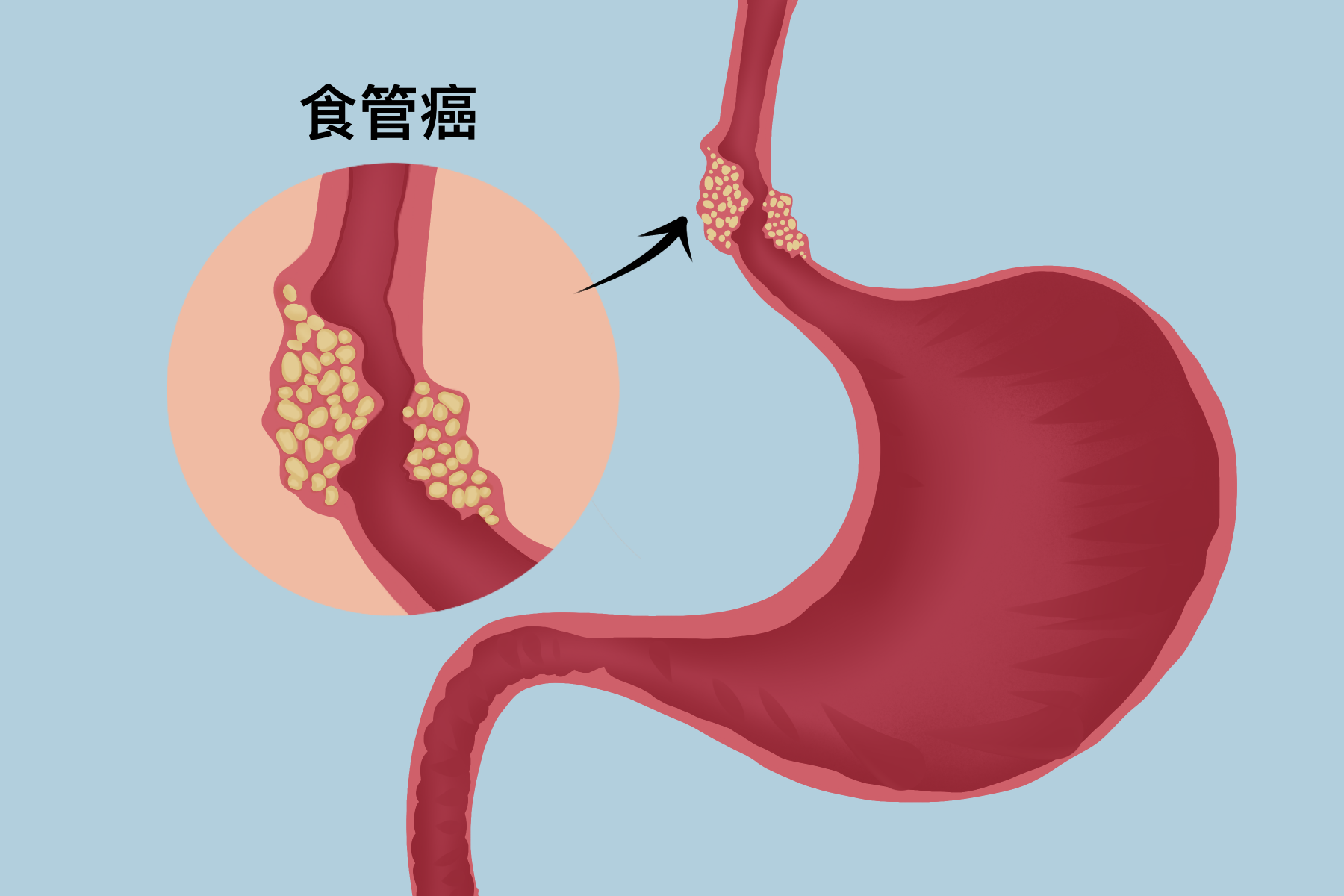 圖文圖片