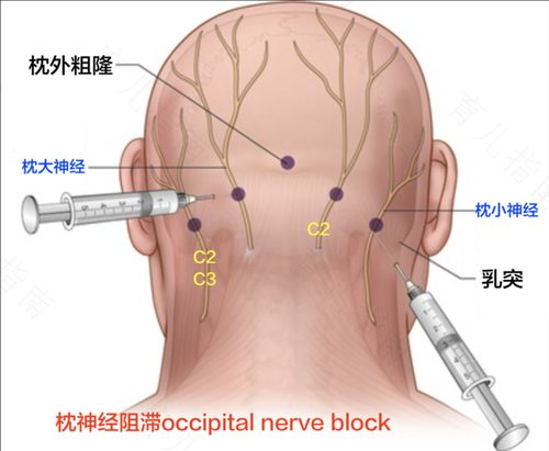 圖文圖片