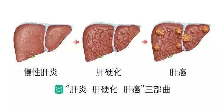 图文图片