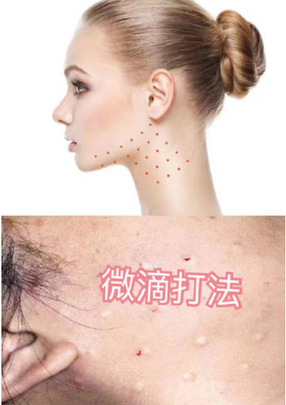 圖文圖片