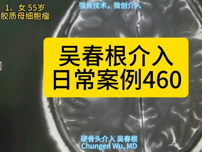 視頻封面