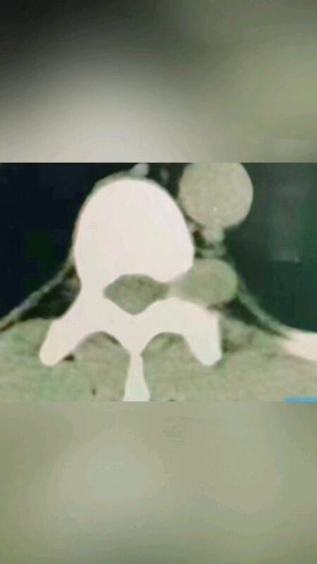 視頻封面