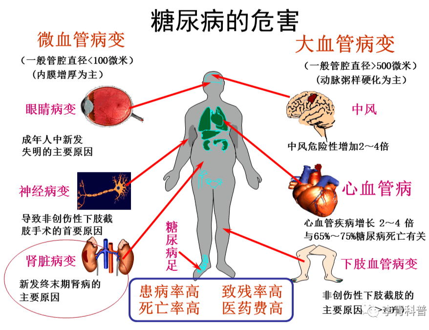 血糖高跟肾什么关系 2oYBAGVQpM-AOLQAAASJM-8X5-Y124.png?_ms_=9506