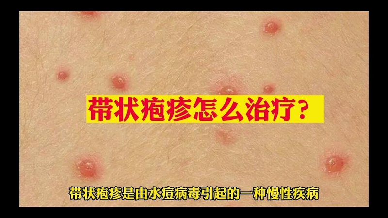 視頻封面