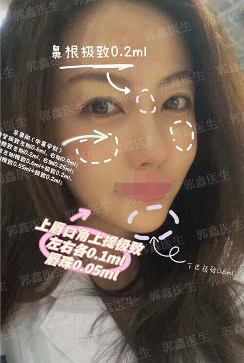圖文圖片