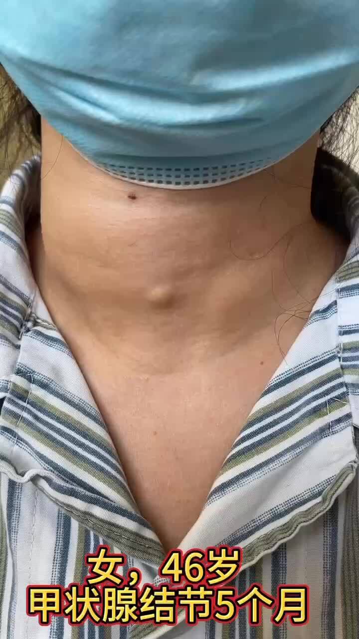 視頻封面