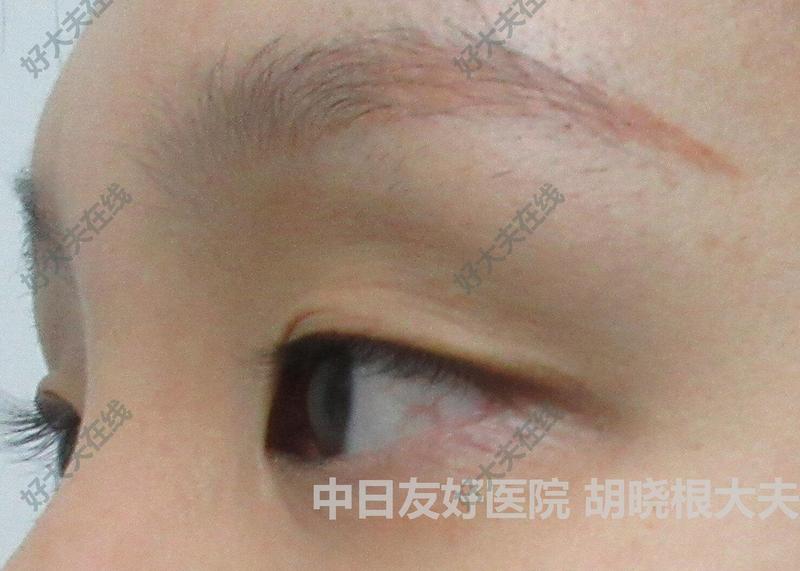 圖文圖片