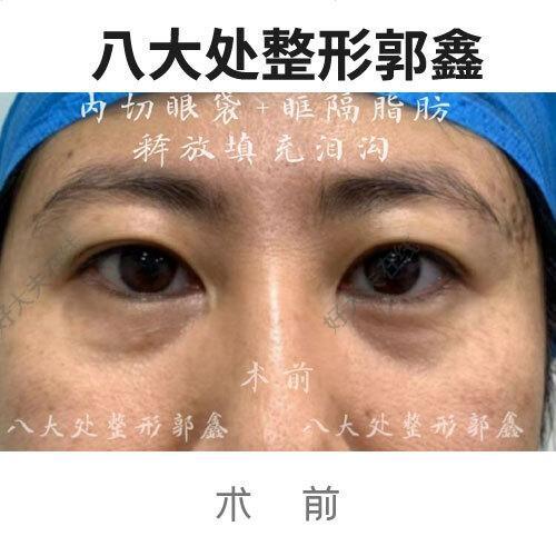 圖文圖片