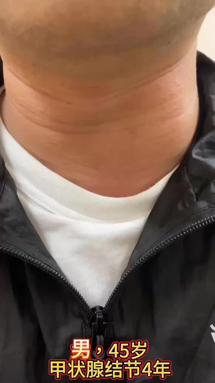 視頻封面