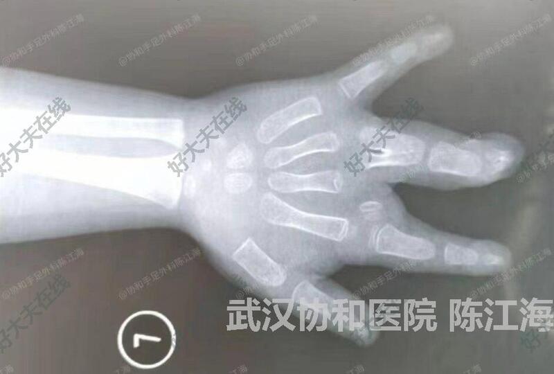 圖文圖片