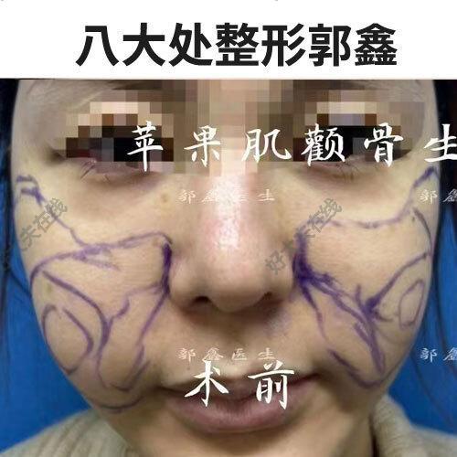 圖文圖片