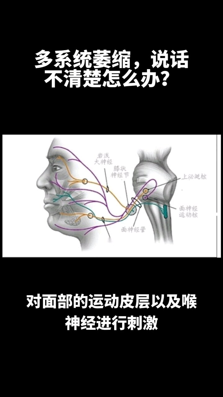 默认图片