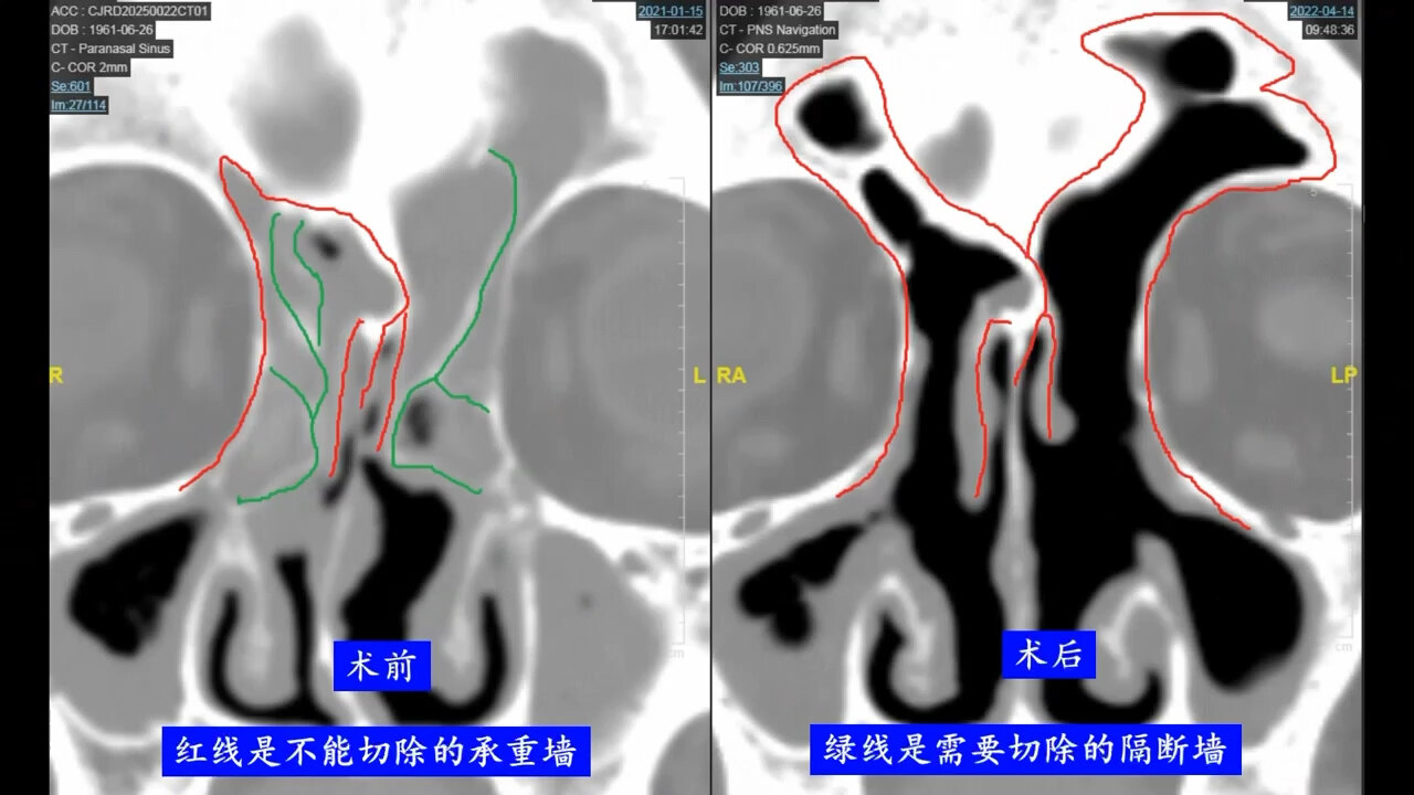 默认图片