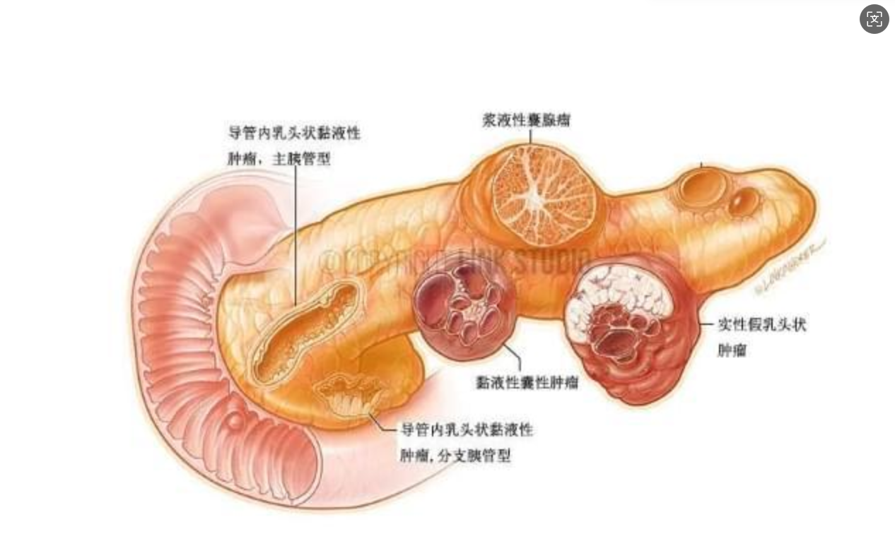 圖文圖片