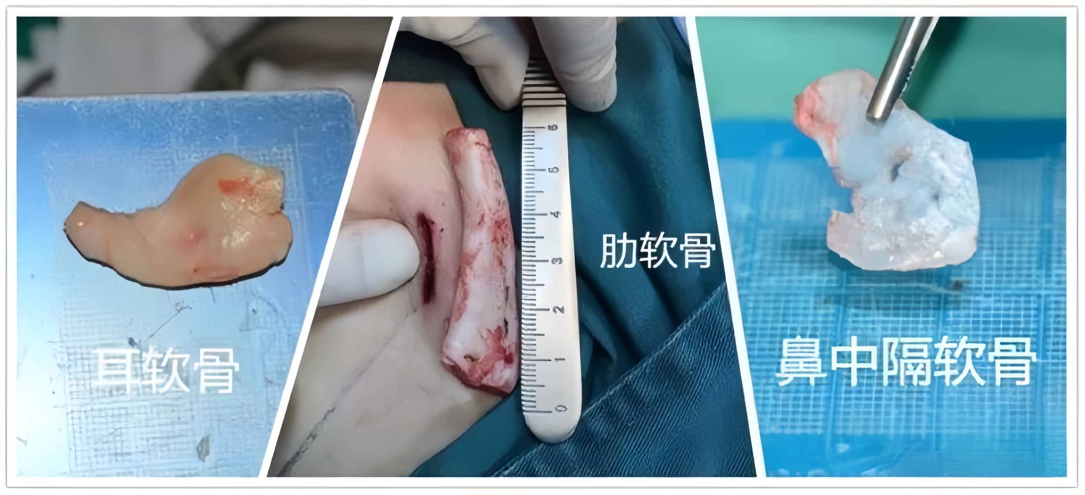 安全套什么材质的比较好 2oYBAGVkD2eATEltAAfVuU14yeA751.jpg?_ms_=1fe2