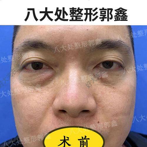 圖文圖片