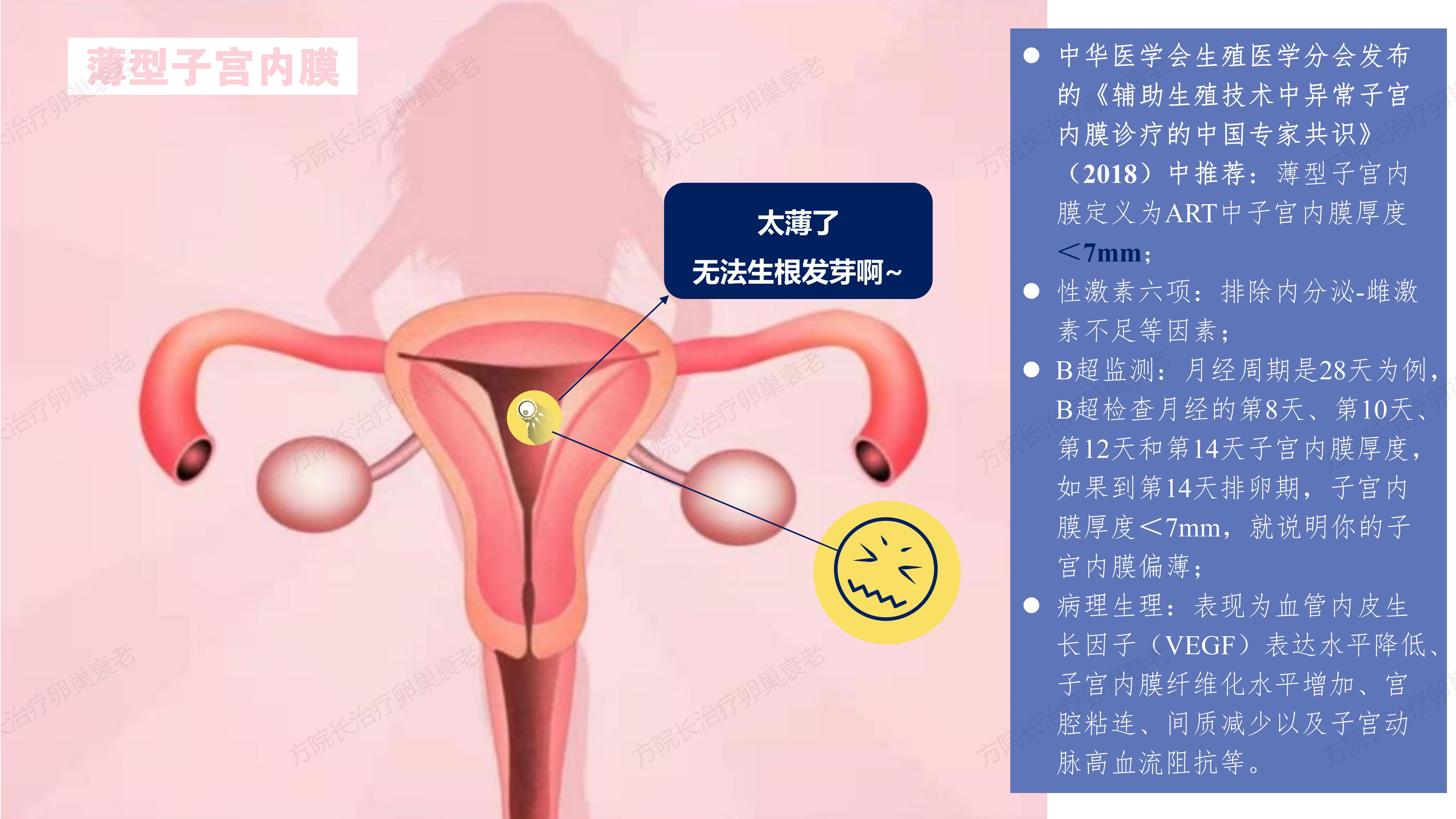 构图：薄型子宫内膜_01.jpg