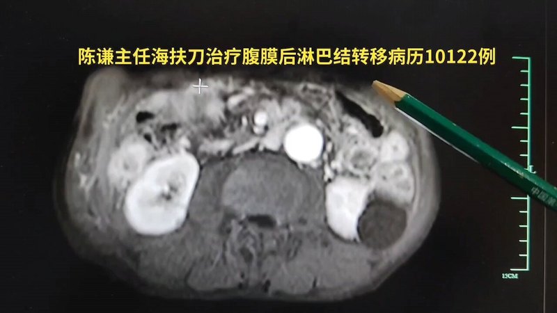 視頻封面