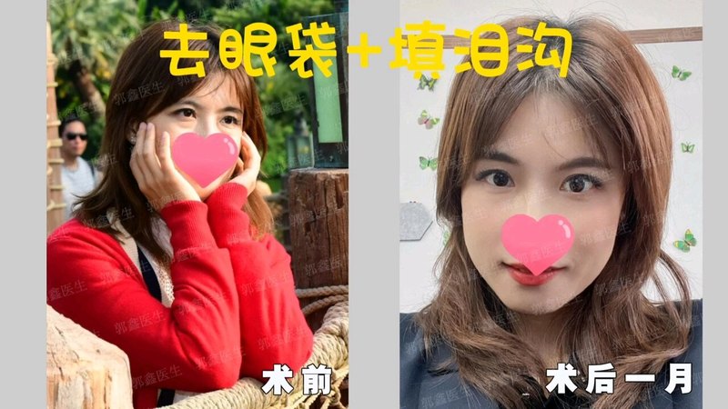 視頻封面
