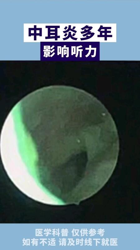 視頻封面