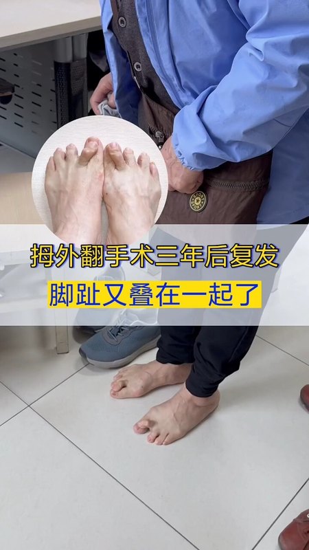 視頻封面