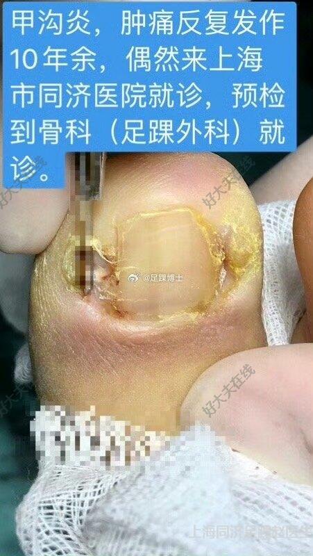 圖文圖片