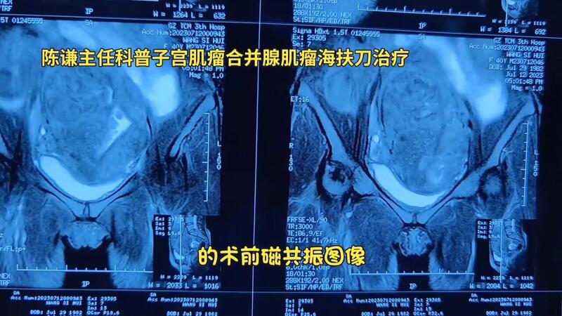 視頻封面