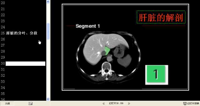 肝脏分段8段CT图图片