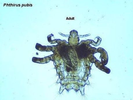 阴虱图片显微镜图片