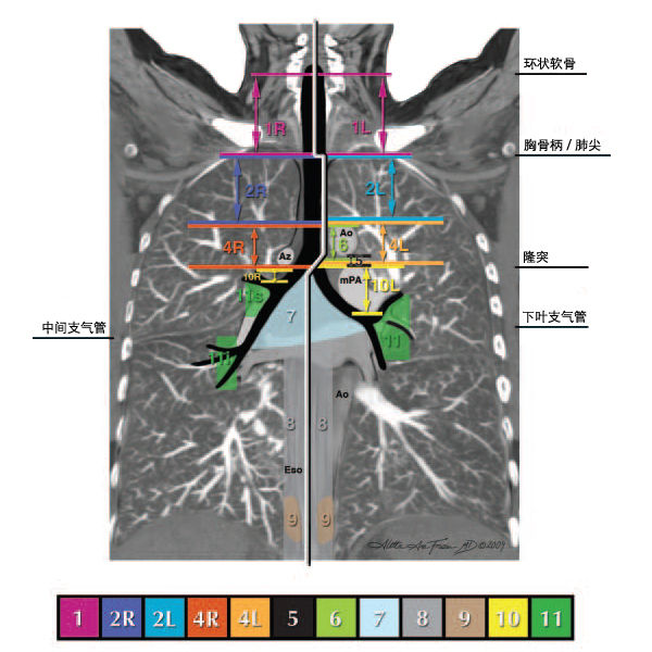纵隔淋巴结分区图谱(美国胸科协会) 