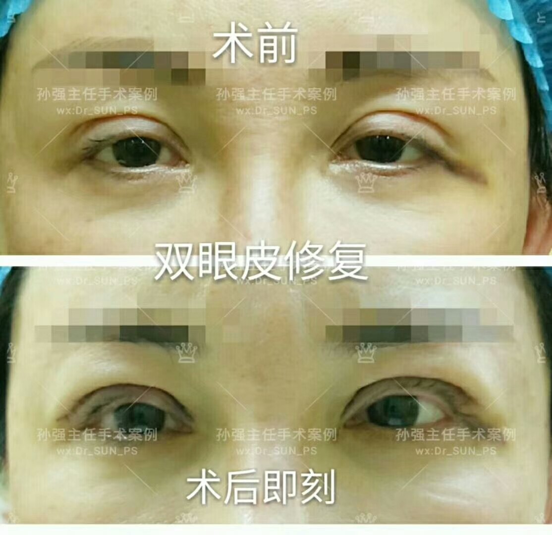 暂无