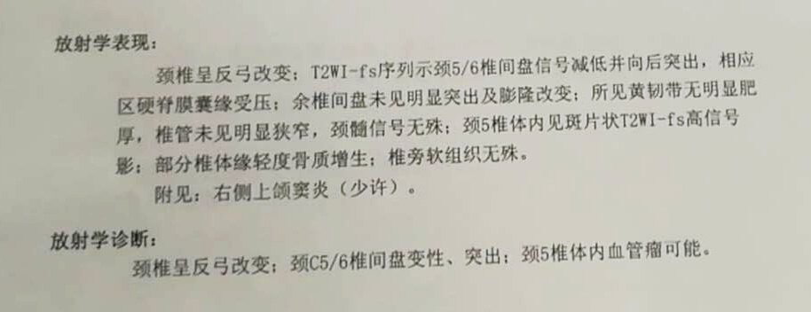 颈椎曲度变直是怎么回事?