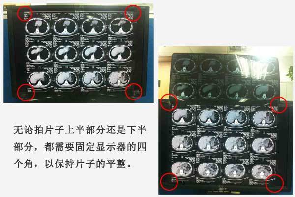 用手机翻拍出清晰标准的影像照片 - 好大夫在线